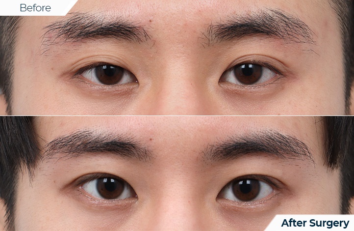 상품53前后照片