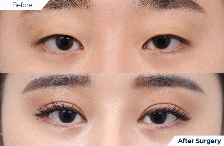 상품54前后照片