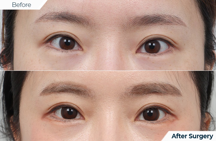 상품56前后照片