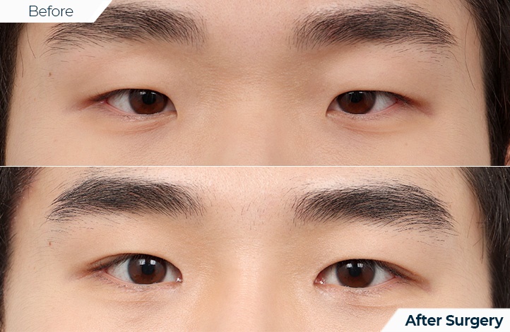 상품55前后照片