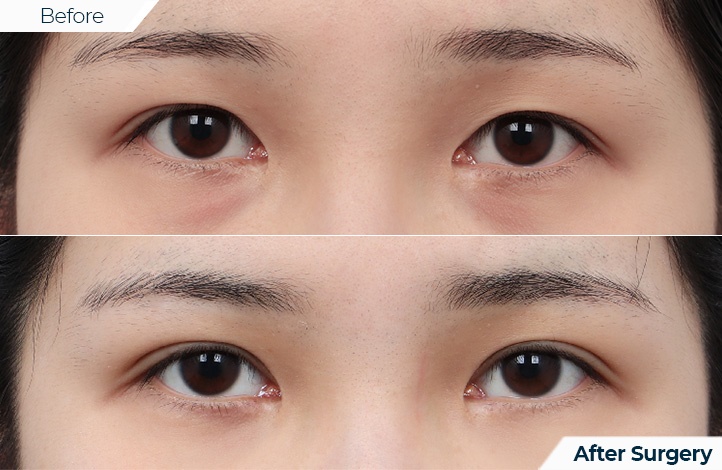 상품57前后照片