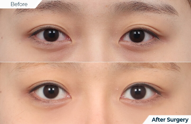 상품58前后照片