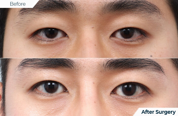 상품59前后照片