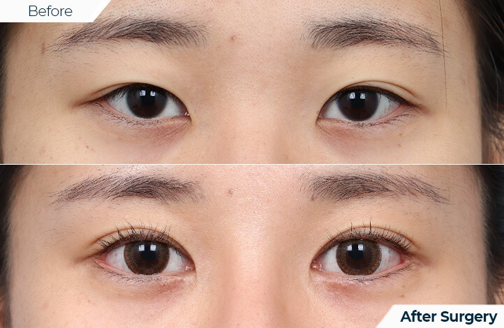 상품60前后照片