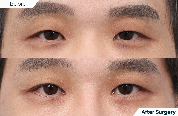 상품61前后照片