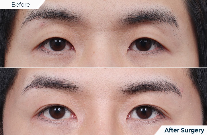 상품63前后照片