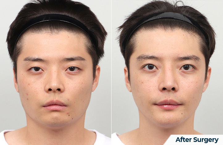 상품64前后照片