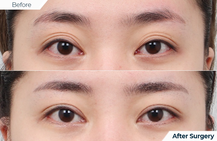 상품65前后照片