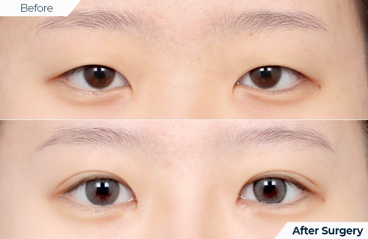 상품66前后照片