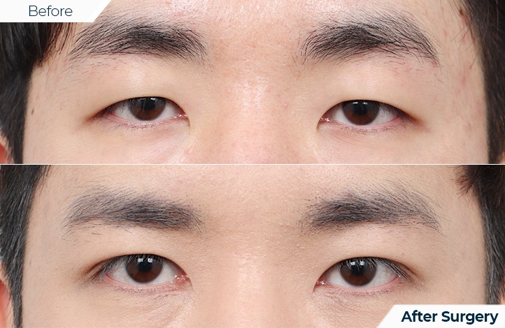 상품67前后照片