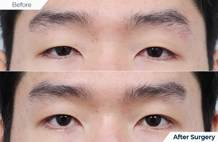 상품68前后照片