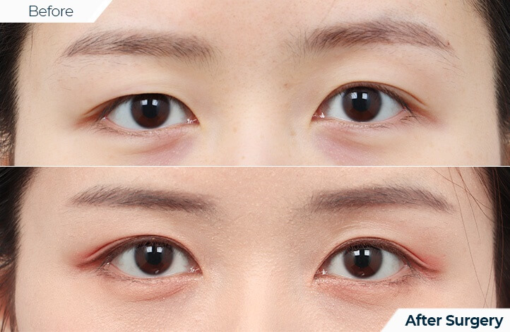 상품70前后照片