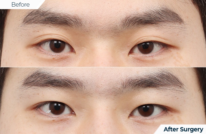 상품73前后照片