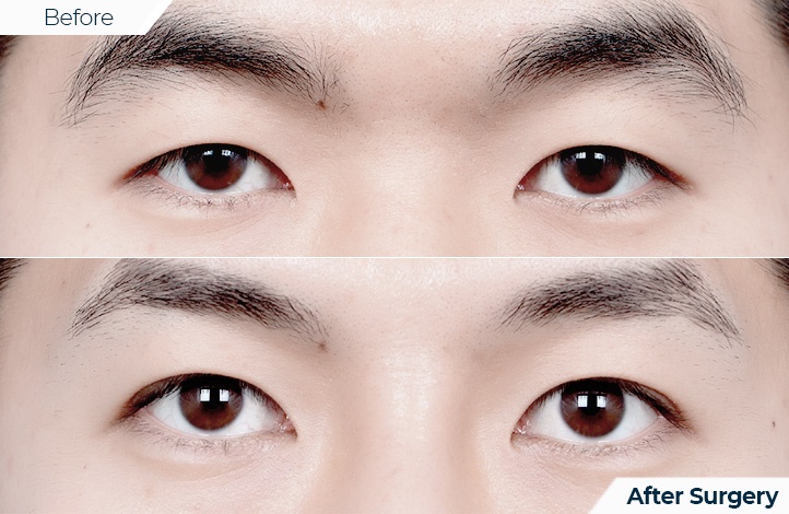 상품74前后照片