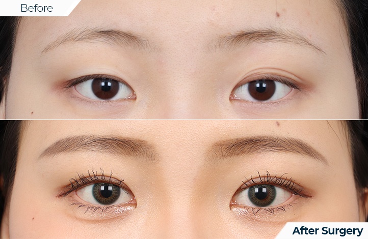 상품76前后照片