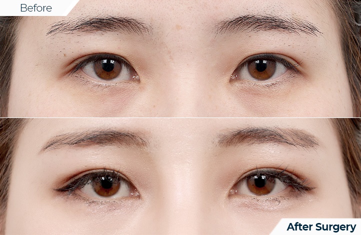 상품77前后照片