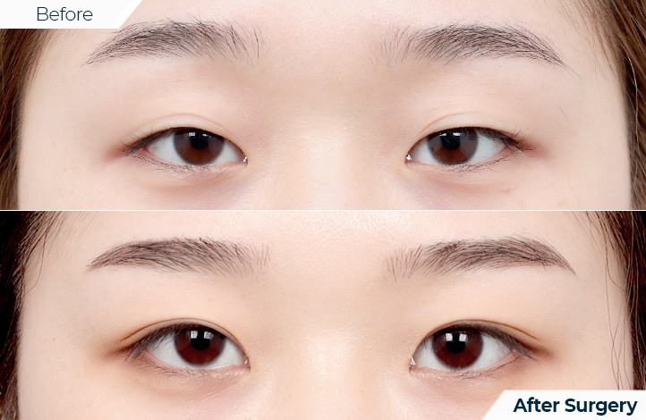 상품78前后照片