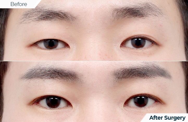 상품79前后照片