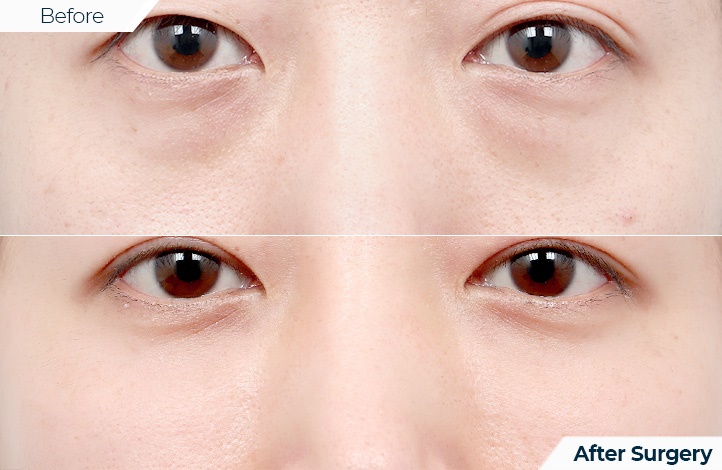 상품80前后照片