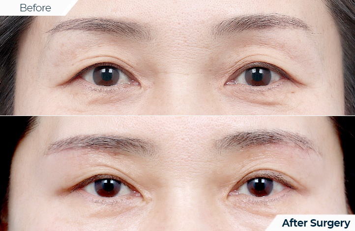 상품81前后照片