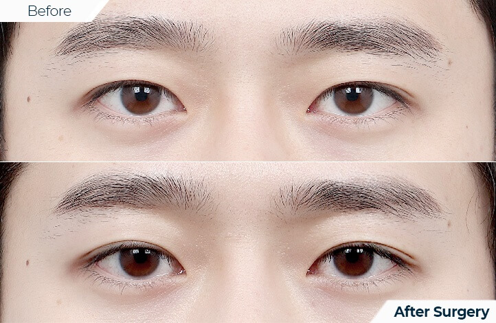 상품83前后照片