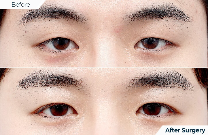 상품84前后照片