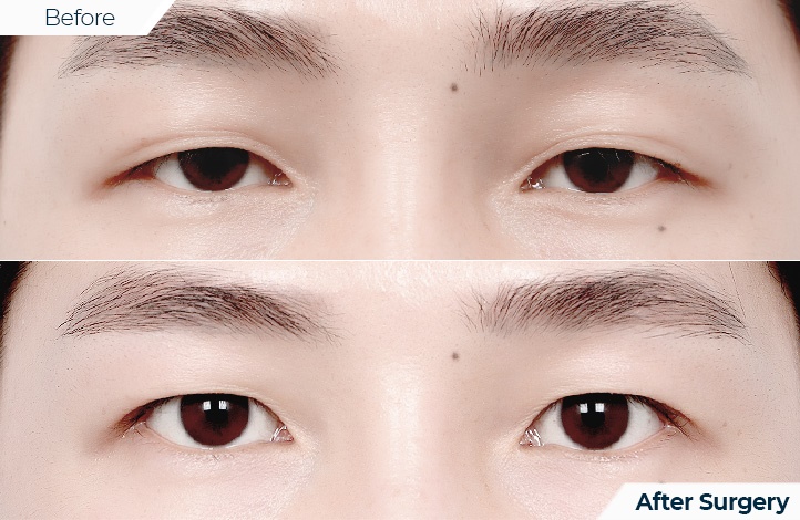 상품86前后照片