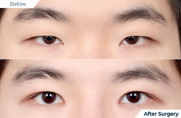 상품88前后照片