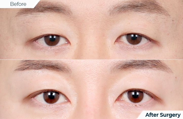 상품89前后照片