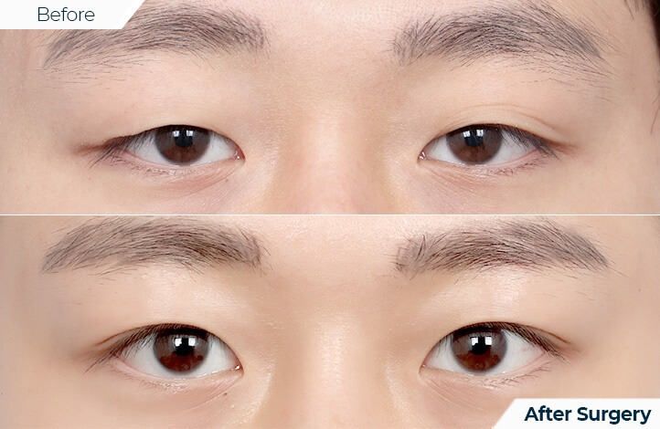 상품90前后照片