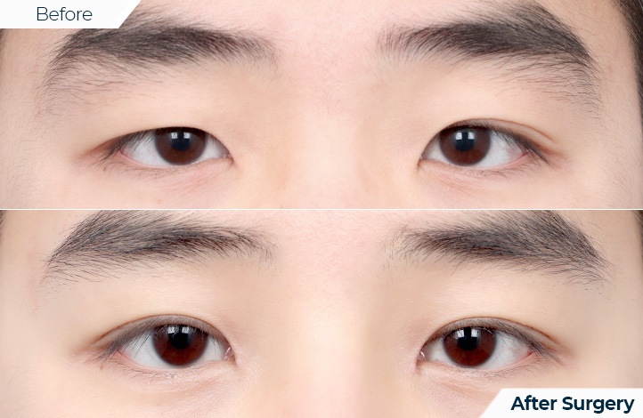 상품91前后照片