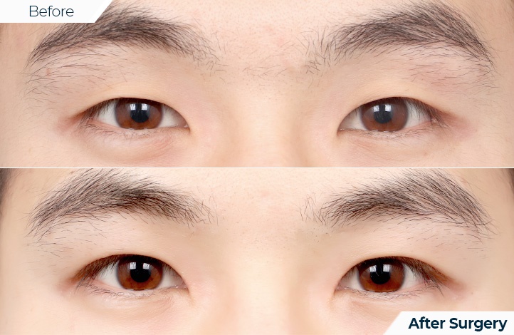 상품96前后照片