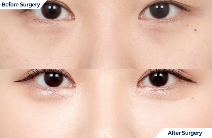 상품97前后照片