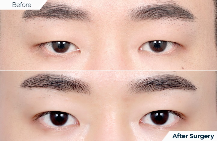 상품98前后照片