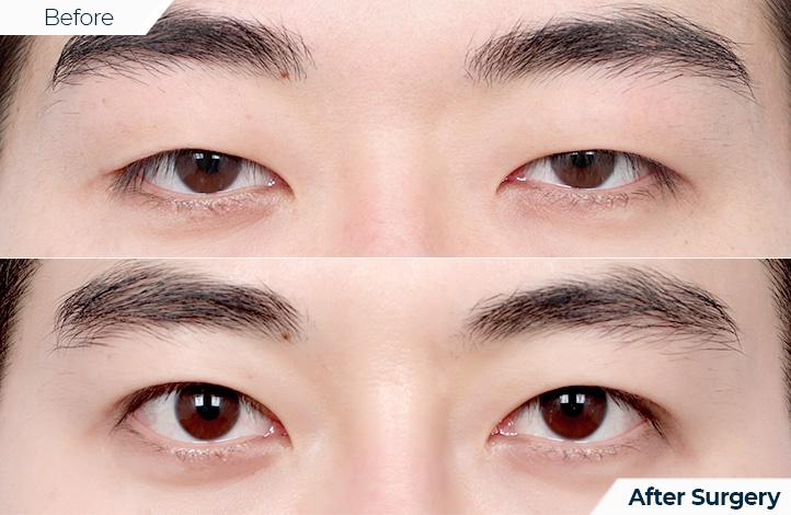 상품99前后照片