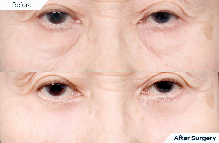 상품100前后照片