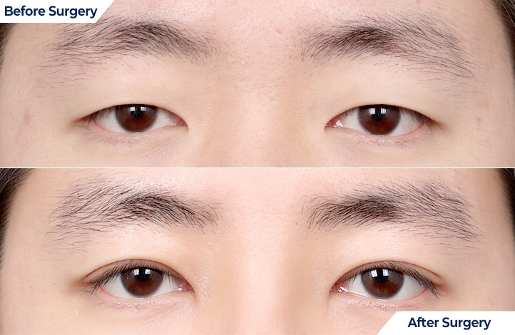 상품104前后照片