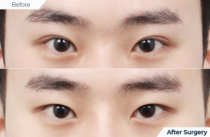 상품105前后照片