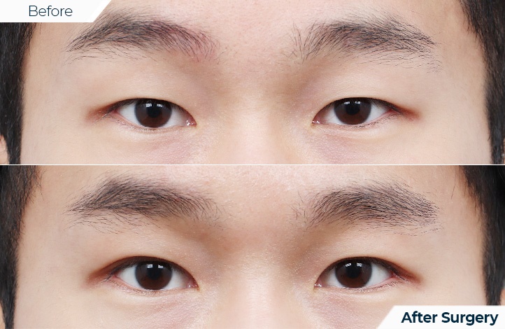 상품106前后照片