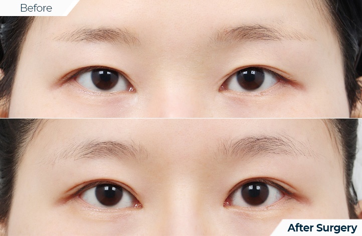 상품107前后照片