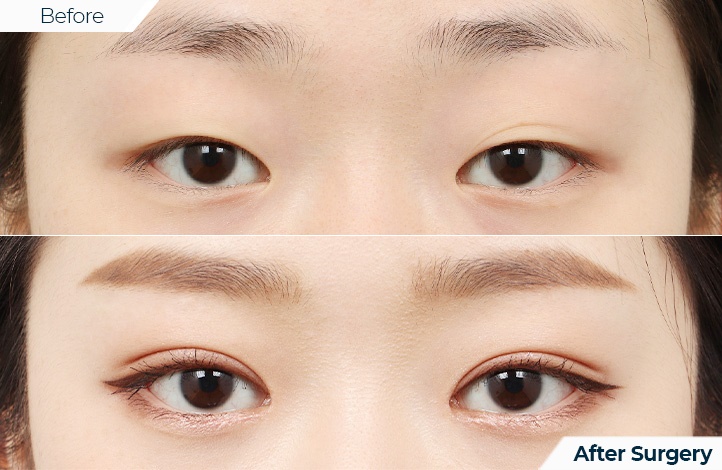 상품108前后照片