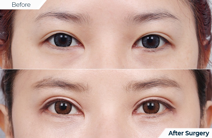 상품109前后照片