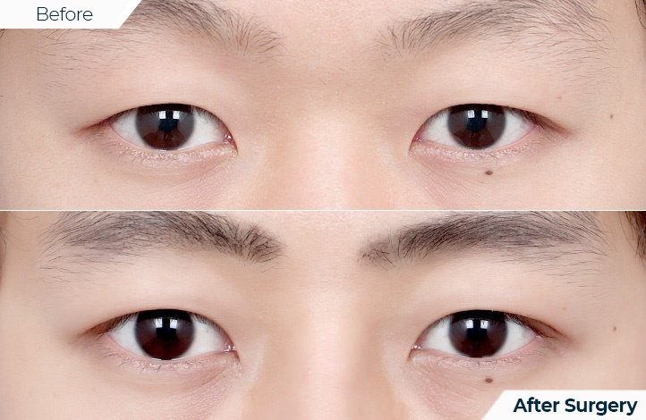 상품111前后照片