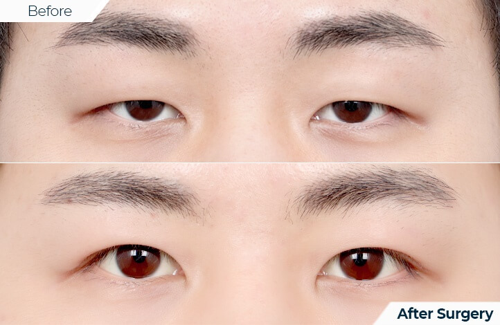 상품117前后照片