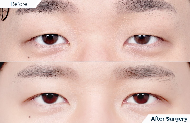 상품119前后照片