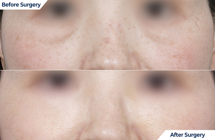 상품120前后照片