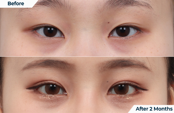 상품121前后照片