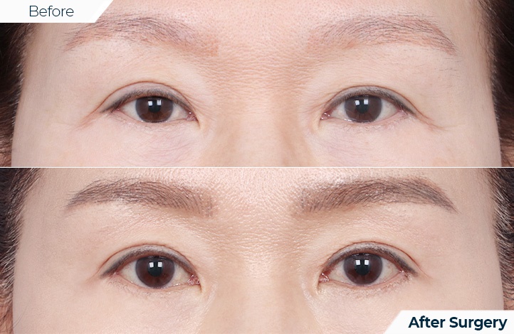 상품123前后照片