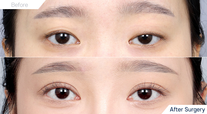 상품125前后照片