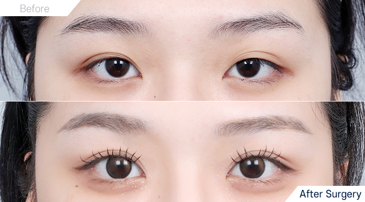 상품127前后照片